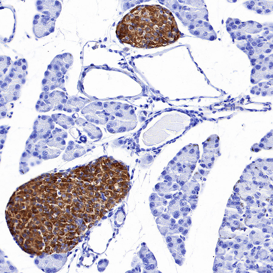 SV2A Recombinant Rabbit mAb (S-3732-3)