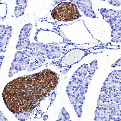SV2A Recombinant Rabbit mAb (S-3732-3)