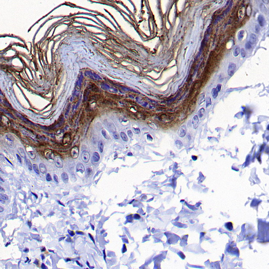KLK5 Recombinant Rabbit mAb (S-4238-55)