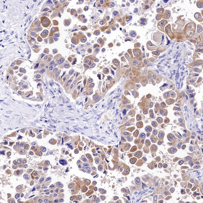 Bcl-xL Recombinant Rabbit mAb (S-487-28)