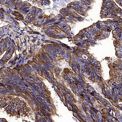 Transgelin 2 Recombinant Rabbit mAb (S-2809-73)