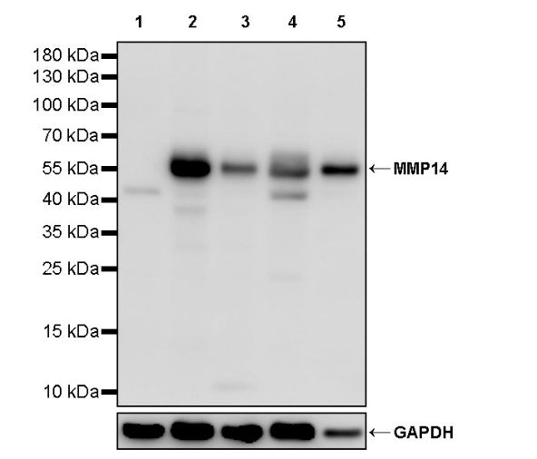 MMP14 Recombinant Rabbit mAb (S-2922-69)