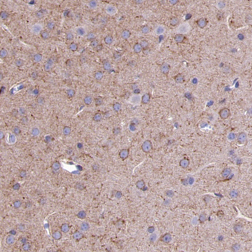 LRP1 Rabbit Polyclonal Antibody