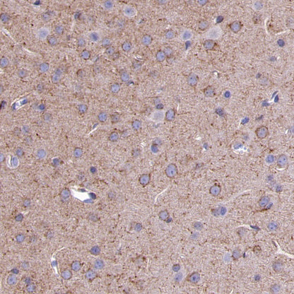 LRP1 Rabbit Polyclonal Antibody