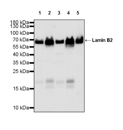 S-RMab®Lamin B2 Recombinant Rabbit mAb (S-951-70)