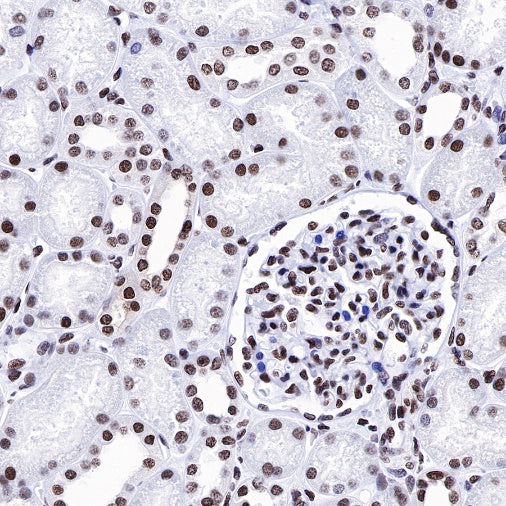 Dnmt1 Recombinant Rabbit mAb (S-R324)