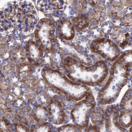 β-tubulin Recombinant Rabbit mAb (SDT-312-113)
