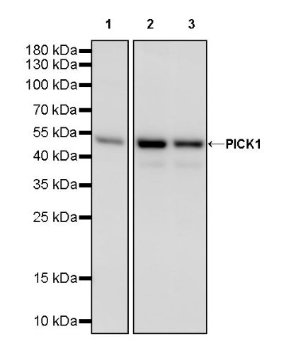 PICK1 Recombinant Rabbit mAb (S-2346-165)