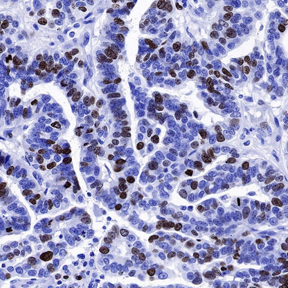 S-RMab® Ki67 Recombinant Rabbit mAb (SDT-R459)