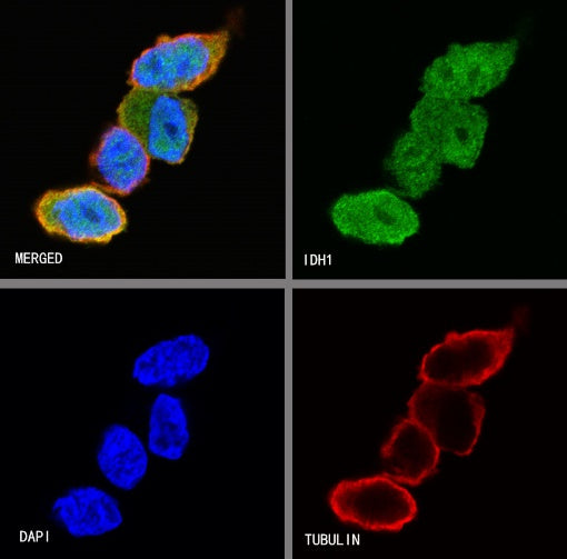IDH1 Recombinant Rabbit mAb (S-792-16)