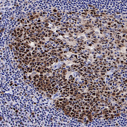 PCNA Recombinant Mouse mAb (S-5477)