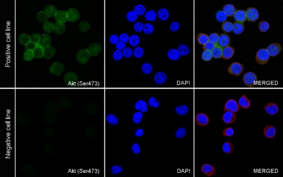 Phospho-Akt (Ser473) Recombinant Rabbit mAb (S-622-64)