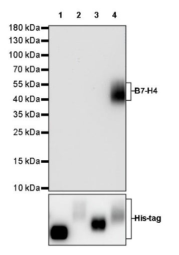 B7-H4 Recombinant Rabbit mAb (SDT-314-447-2)