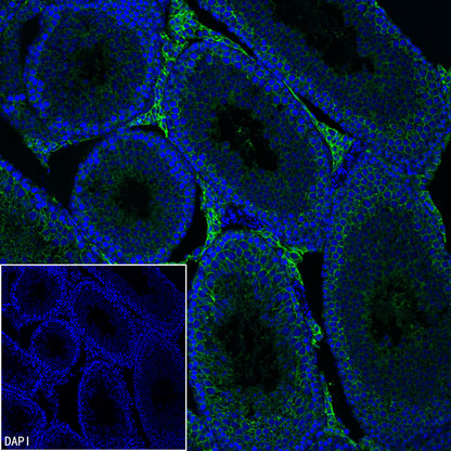 SLC7A5 Recombinant Rabbit mAb (S-4496-55)