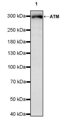 ATM Recombinant Rabbit mAb (S-2178-4)