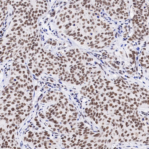 RBM15B Recombinant Rabbit mAb (S-1326-111)