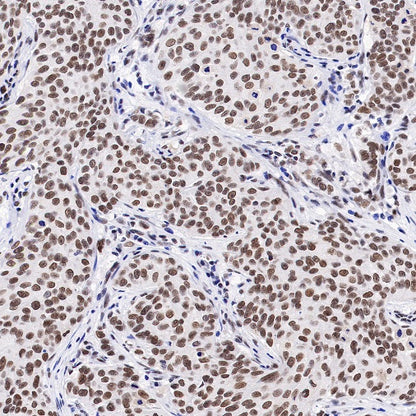 RBM15B Recombinant Rabbit mAb (S-1326-111)