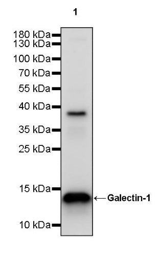 Galectin-1/LGALS1 Rabbit Polyclonal Antibody