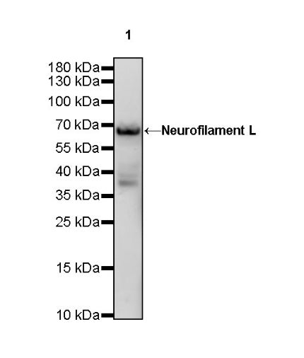 Neurofilament L Recombinant Rabbit mAb (S-635-214)