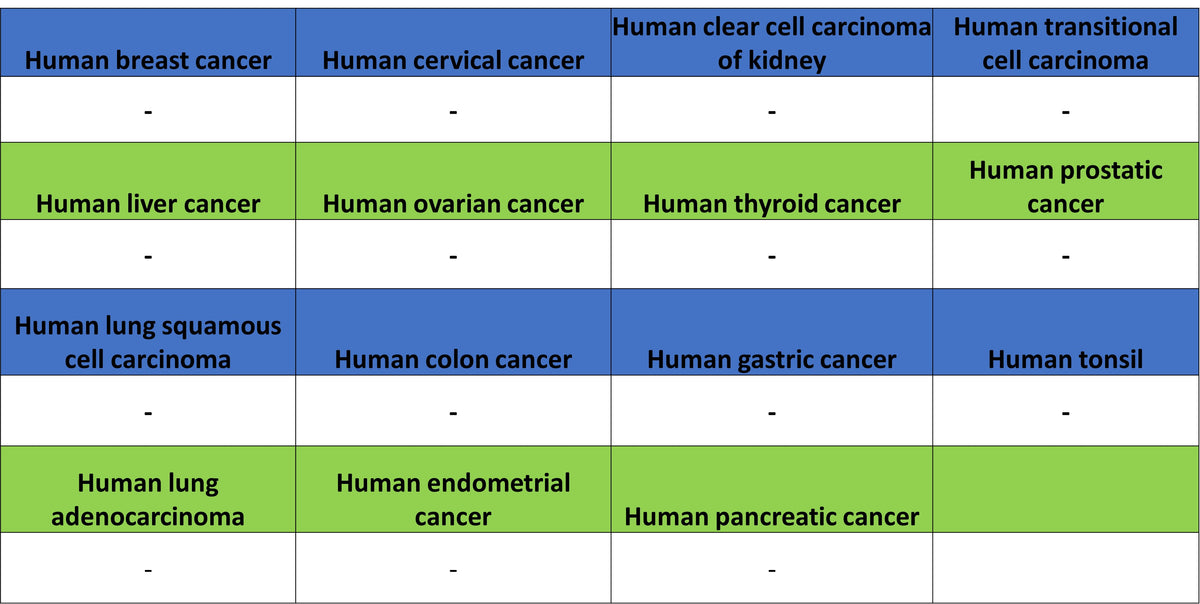 MYBPC3 Recombinant Rabbit mAb (S-5476)