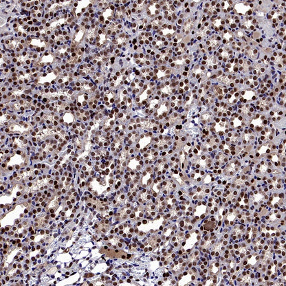 TKT Rabbit Polyclonal Antibody