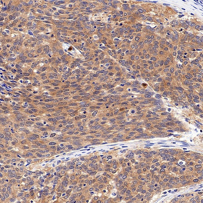 IFIH1 Recombinant Rabbit mAb (S-2413-49)