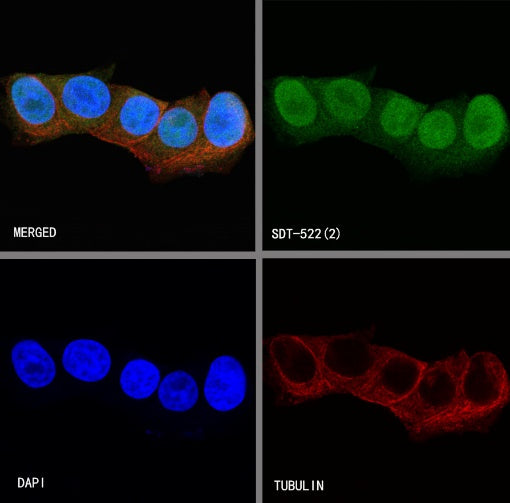 MGMT Recombinant Rabbit mAb (SDT-522-71)