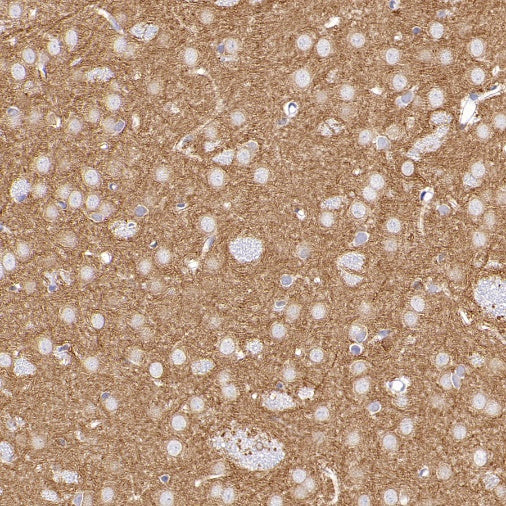 MAP2 Recombinant Rabbit mAb (SDT-2060-28)