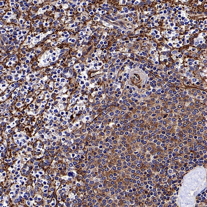 Transgelin 2 Recombinant Rabbit mAb (S-2809-73)