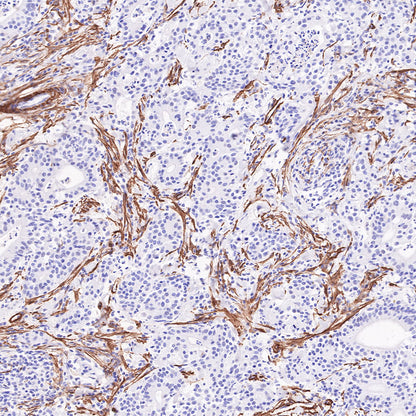 alpha smooth muscle Actin Recombinant Mouse mAb (SDT-R142)