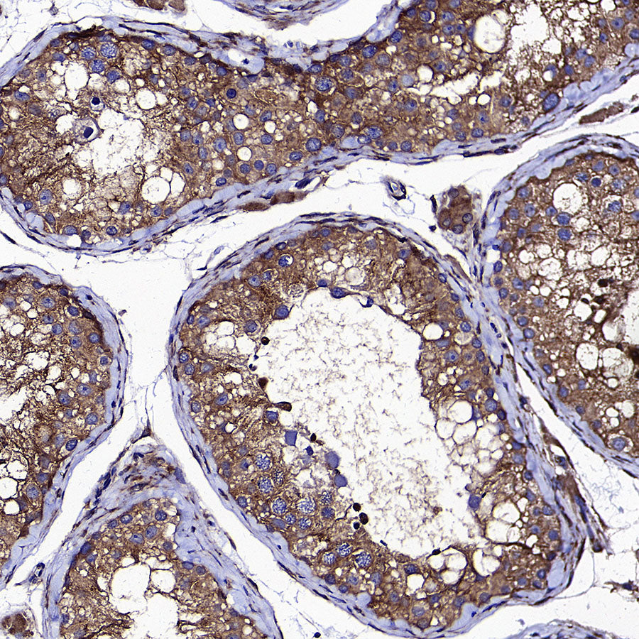 PUMA Recombinant Rabbit mAb