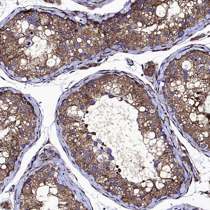 PUMA Recombinant Rabbit mAb