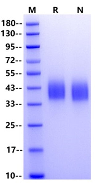 SLAMF7/CRACC/CD319 His Tag Protein, Human