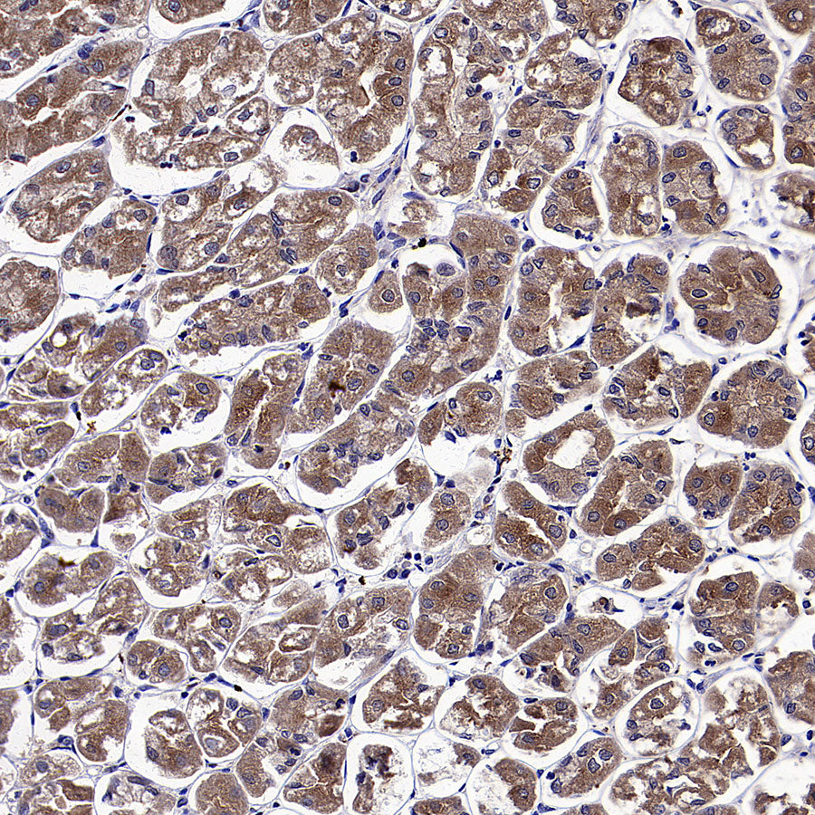 ClpX Recombinant Rabbit mAb (S-4460-33)