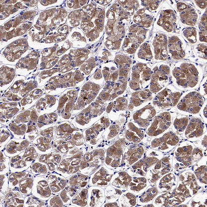 ClpX Recombinant Rabbit mAb (S-4460-33)