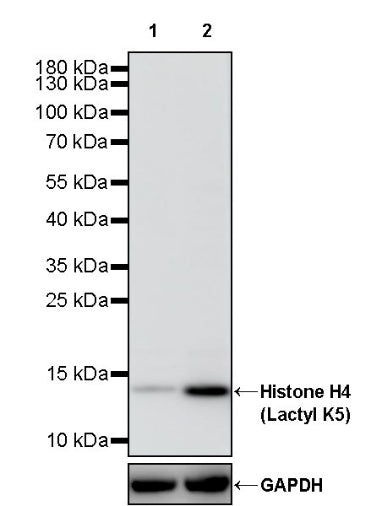 Histone H4 (Lactyl K5) Recombinant Rabbit mAb (S-3220-73)