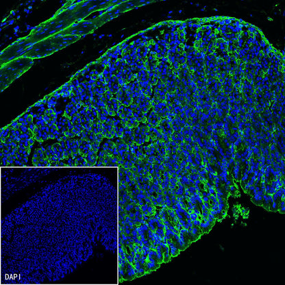 pan (alpha) actin Recombinant Rabbit mAb (SDT-044-17)