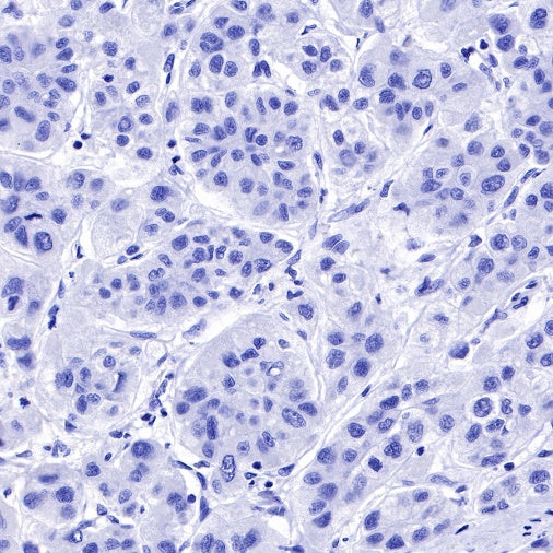 CK-13 Recombinant Rabbit mAb (SDT-641-41)