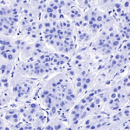 CK-13 Recombinant Rabbit mAb (SDT-641-41)