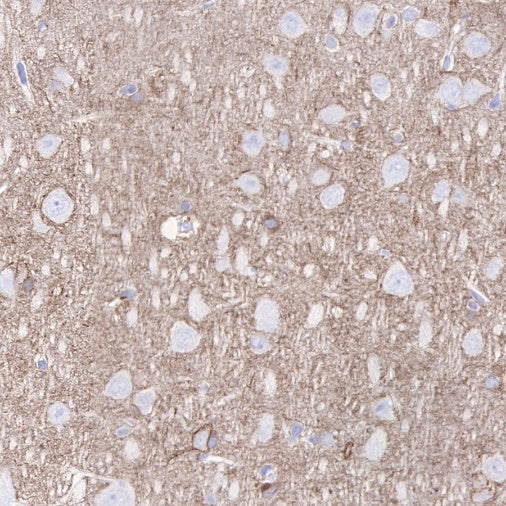 PKC alpha Recombinant Rabbit mAb (S-624-36)