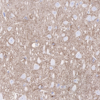 PKC alpha Recombinant Rabbit mAb (S-624-36)