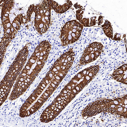 CDH17 Recombinant Rabbit mAb (SDT-3276-83)