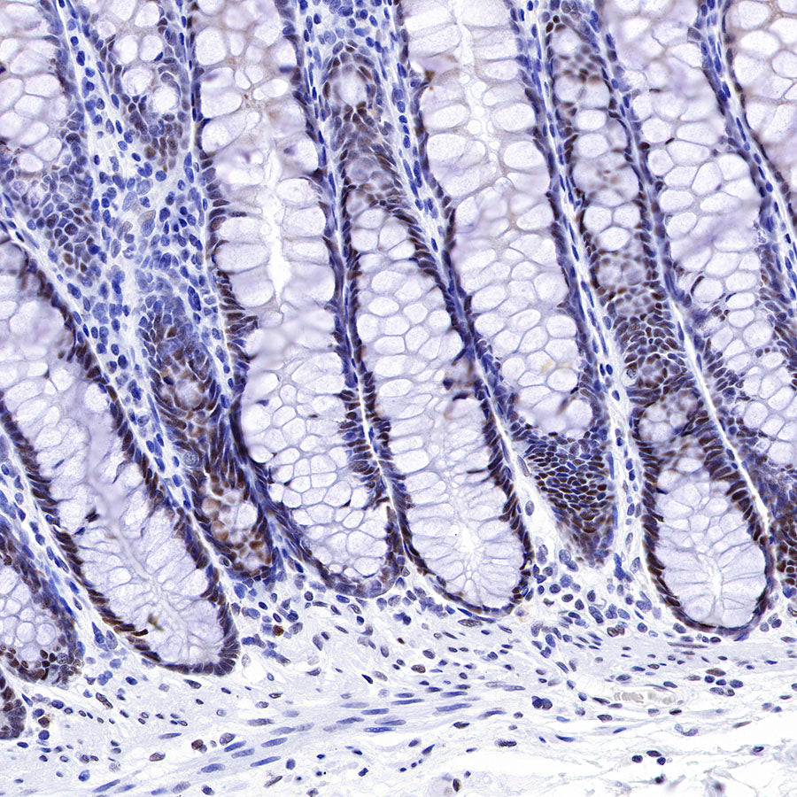 MSH2 Recombinant Rabbit mAb (SDT-037-20)