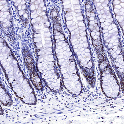 MSH2 Recombinant Rabbit mAb (SDT-037-20)