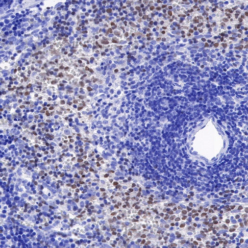 PAX5 Recombinant Rat mAb (S-R200)