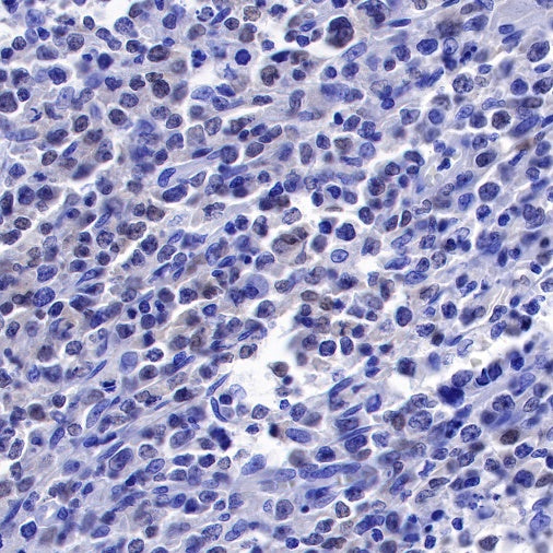 PAX5 Recombinant Rat mAb (S-R200)