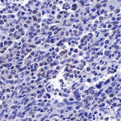 PAX5 Recombinant Rat mAb (S-R200)