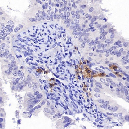 TNFRSF17/BCMA Recombinant Rabbit mAb (S-4674)
