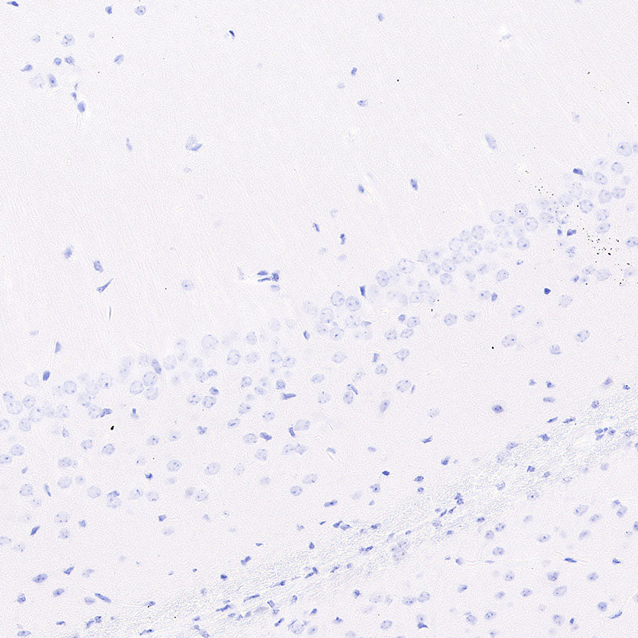 groEL Recombinant Rabbit mAb (S-4634-25)