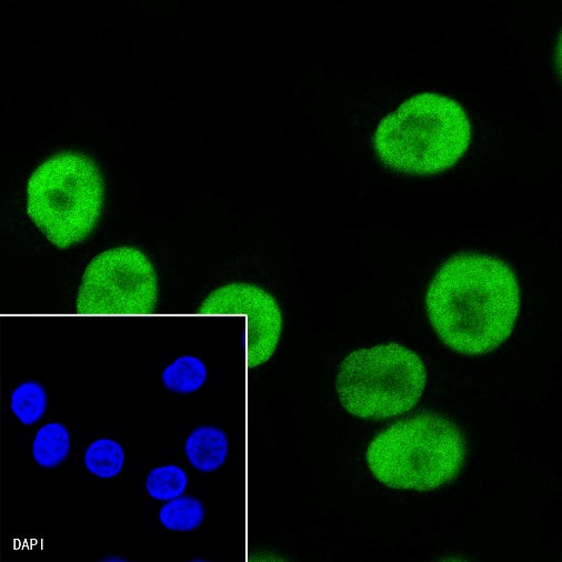 S-RMab® SOX10 Recombinant Rabbit mAb (SDT-R233)